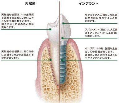 横浜市 西区の歯医者 岡田歯科医院です。 西区 浅間町の口腔外科 歯内